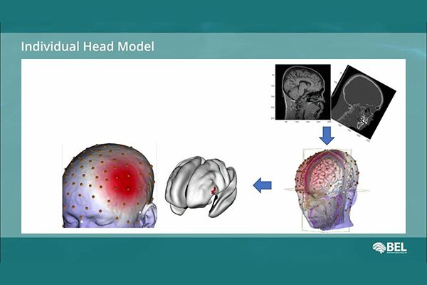 脑电图源定位系统SOURCERER - 图片 4