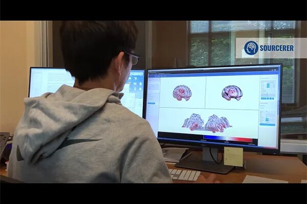 脑电图源定位系统SOURCERER - 图片 5