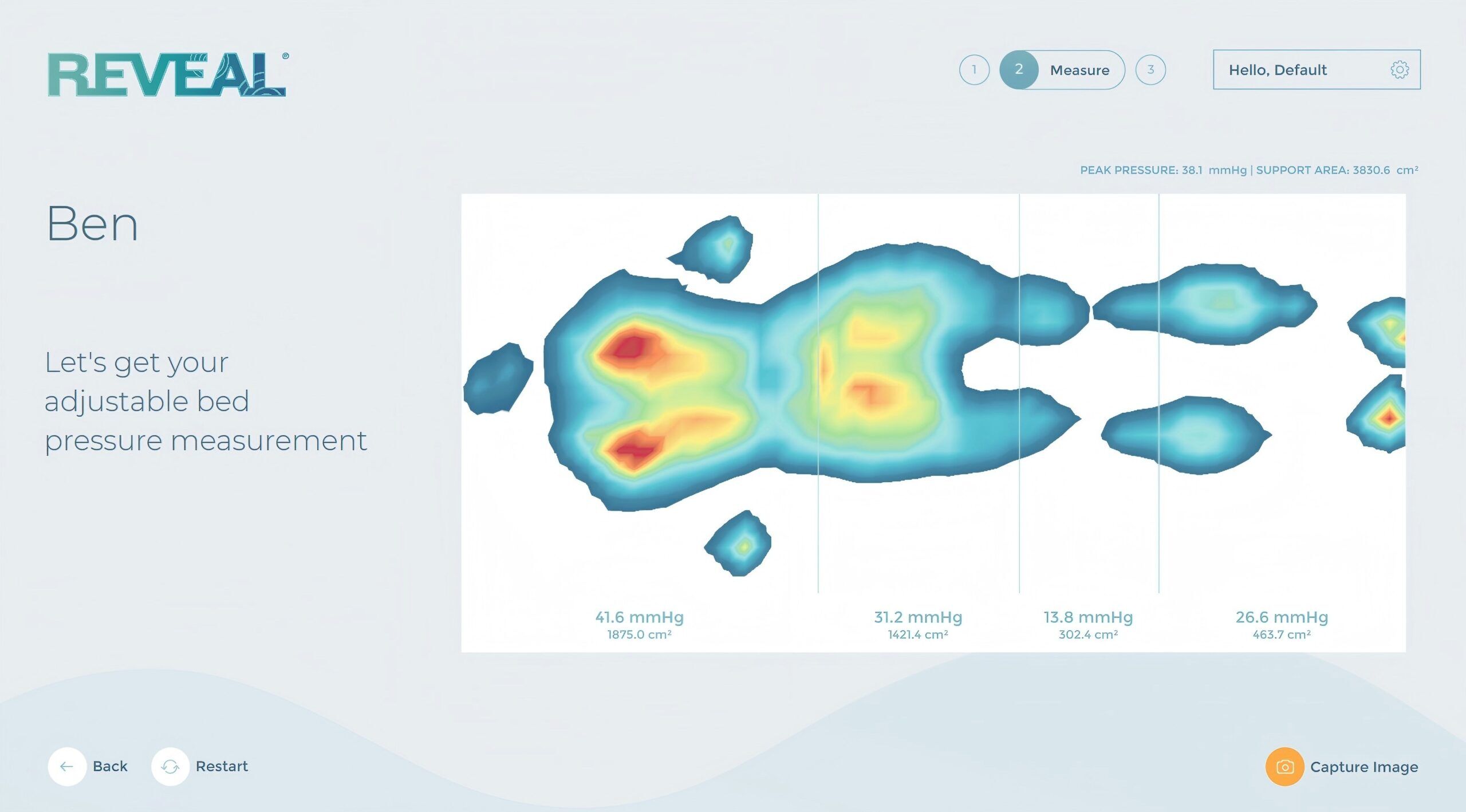 XSENSOR REVEAL X3 压力分布系统
