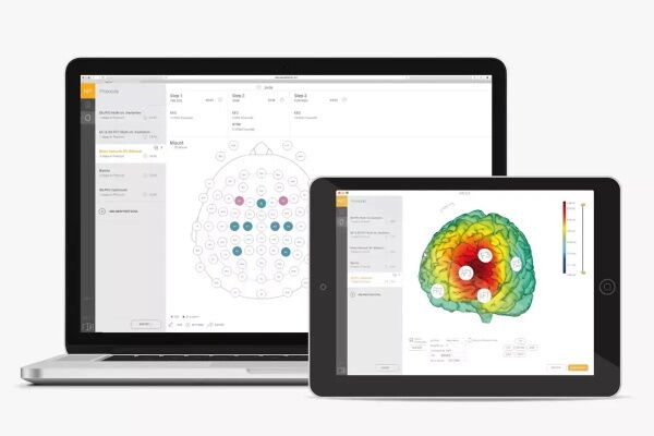 经颅电刺激系统Starstim - 图片 4