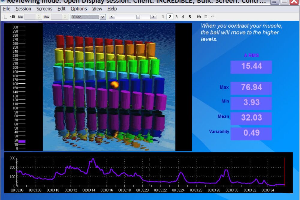 生理反馈仪TT - 图片 3