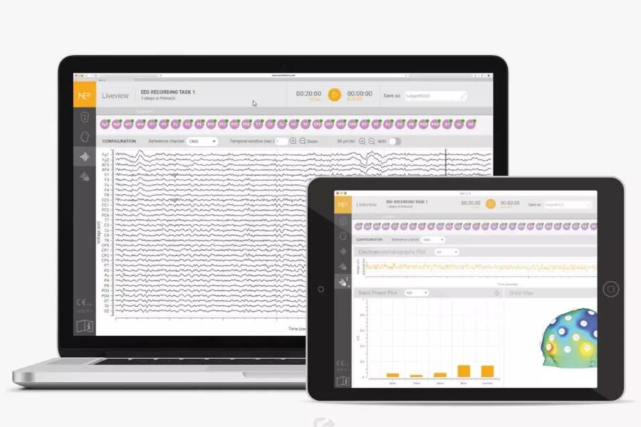无线干电极脑电系统Enobio - 图片 5