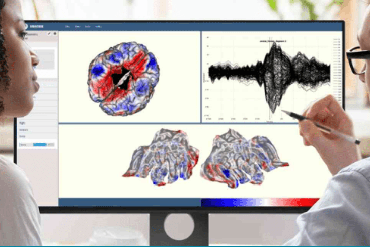 高密度脑电系统BEL ONE - 图片 2