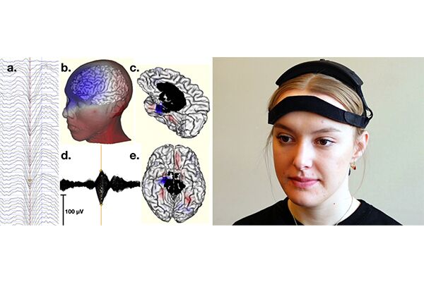 无线睡眠监测治疗系统WISP - 图片 6